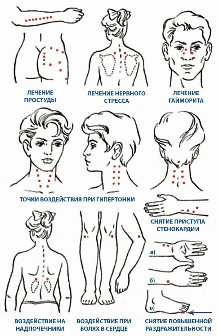 Технологическая схема массажа при гипертонической болезни